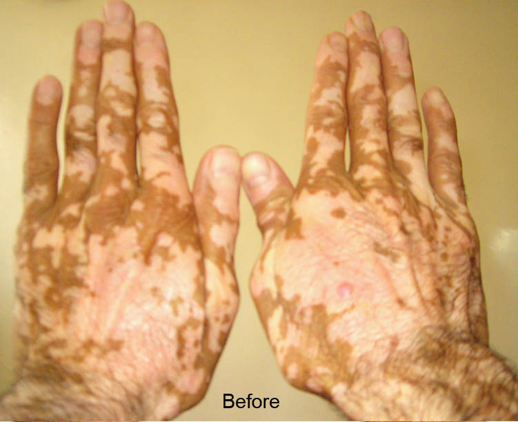 [تصویر: Before.jpg]