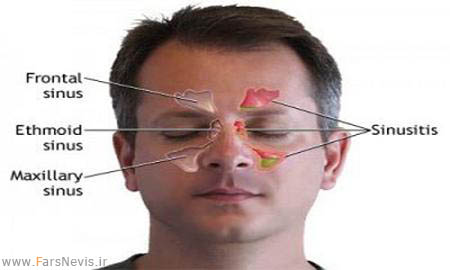 sinuses 300x240 اعضای به درد نخور و بی مصرف بدن + عکس