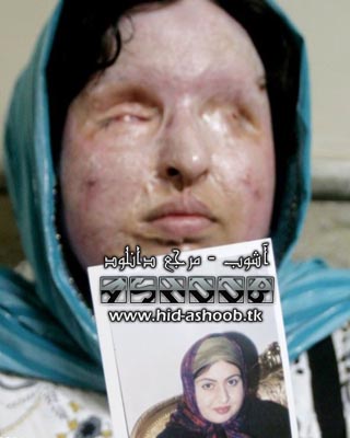 نامه تکان دهنده خواهر آمنه بهرامی قربانی اسیدپاشی | www.hid-ashoob.tk