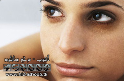 www.hid-ashoob.tk | از بین بردن سیاهی زیر چشم