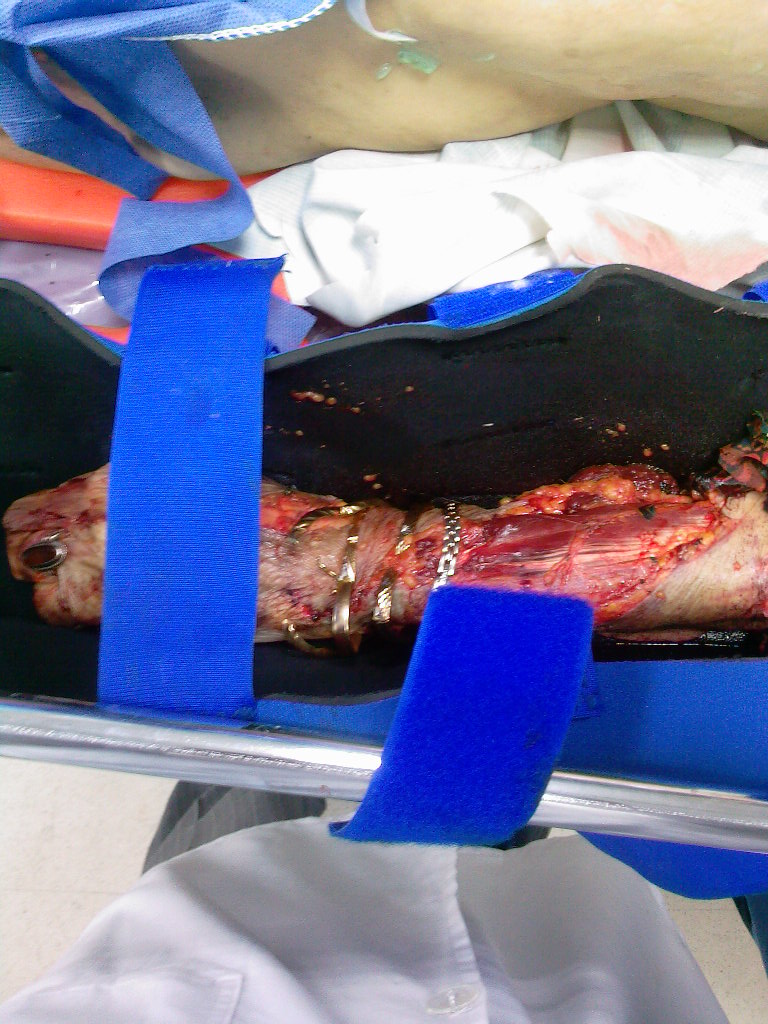 http://s1.picofile.com/file/6973362172/pirzanibaghatepa2.jpg