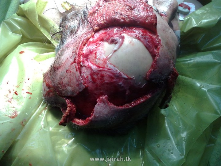 http://s1.picofile.com/file/7108939458/puste_sare_kande_shode.jpg