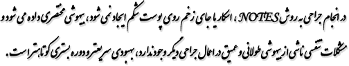 در انجام جراحی به روش NOTES ، اسکار یا جای زخم روی پوست شکم ایجاد نمی شود ، بیهوشی مختصری داده می شود و مشکلات تنفسی ناشی از بیهوشی طولانی و عمیق در اعمال جراحی دیگر وجود ندارد ، بهبودی سریعتر و دوره بستری کوتاهتر است. 
