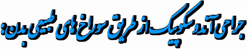 جراحی آندوسکوپیک از طریق سوراخ های طبیعی بدن: