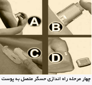 چهار مرحله راه اندازی حسگر متصل به پوست