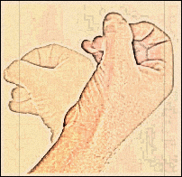 مبارزه با خودارضایی