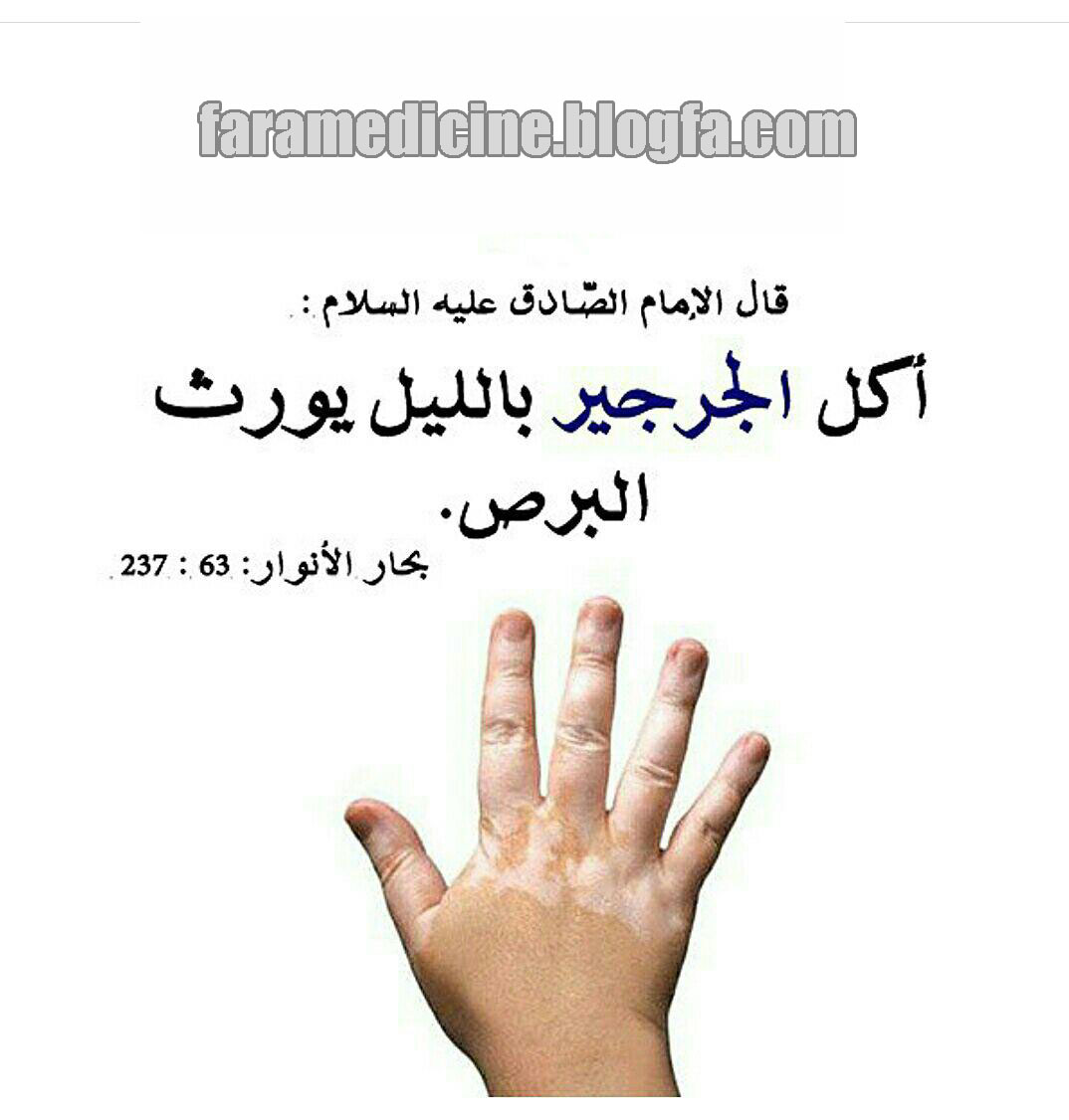 برص، پیسی، ویلتیگو