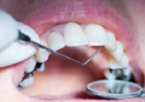 با خرابکارترين دندان جهان آشنا شويد